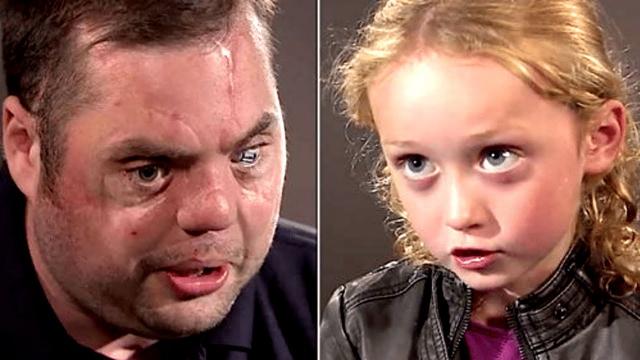 Disfigured Veteran With Scars Says Hi To 5 Year Old Her Response Brings Millions To Tears