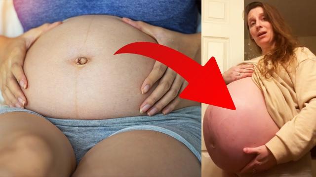 Surrogate mother thought they were twins, but her belly wouldn't stop growing