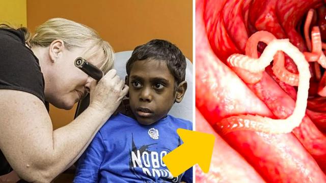 They Thought He Had A Piece Of Pencil In His Ear - Then The Doctor Gasps Seeing This Inside !
