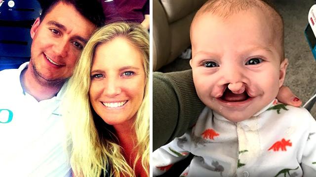 Parents refuse to abort their ‘deformed’ baby — just look at him 2 years later