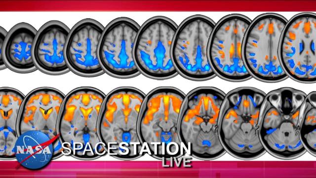Space Station Live: The Brain in Space