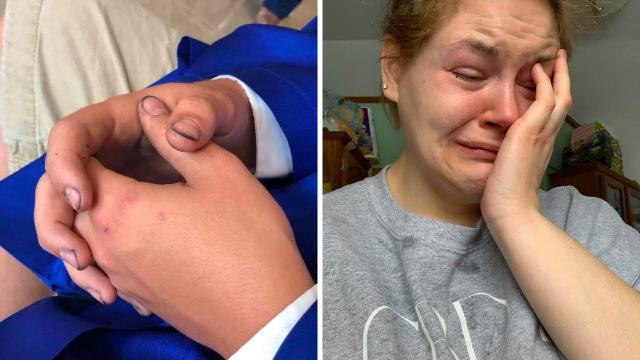 Mom Sees Son’s Hands On Picture Day, Breaks Down Over His Reality