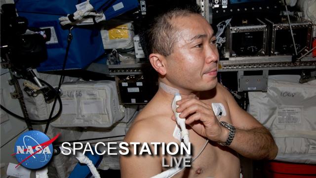 Space Station Live: Vascular Echo