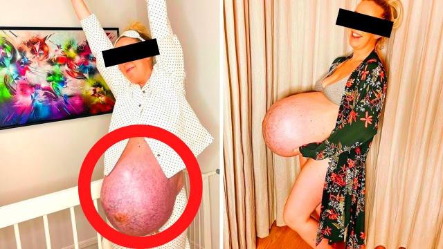 Doctor Shocked When He Found Out Why This Pregnant Woman Baby Bump Was Strangely Huge !