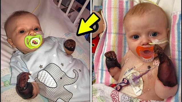 Baby Started Losing His Hands , Mom Looks Closer & Runs To The Doctor