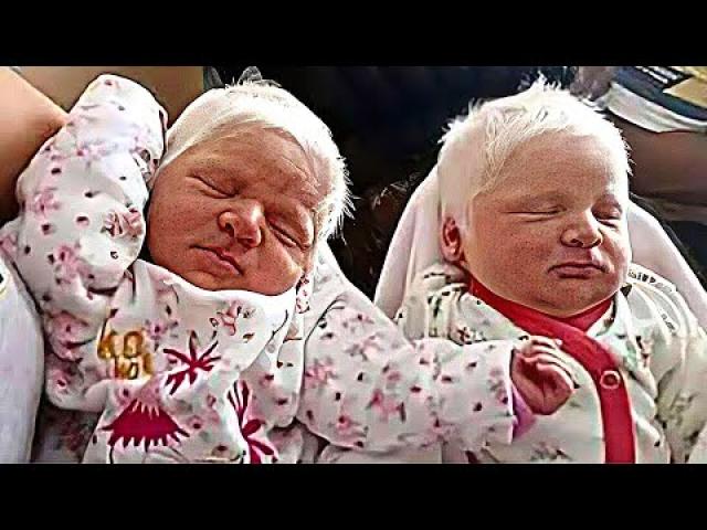 She gave birth to twin albinos with white hair… Here is what they look like now !!