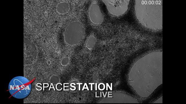 Space Station Live: The Heart of the Matter
