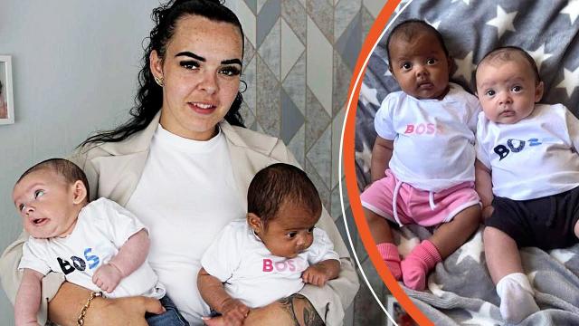 White Mom Gave Birth to Twins with Different Skin Colors – People Say She Needs to Do a Dna Test