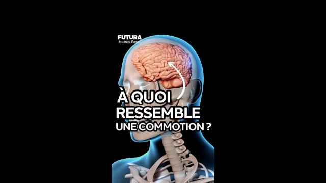 La répétition du jeu de tête provoquerait des traumatismes au cerveau des joueurs !