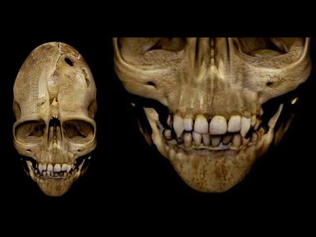 The Intriguing Story of the Andover Skull