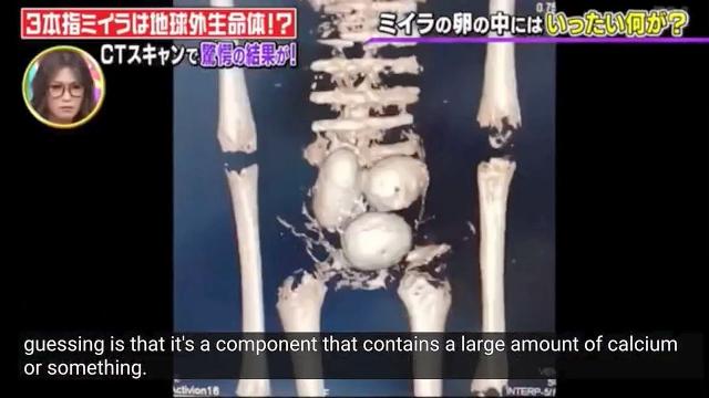 Analysis of Nazca’s mummified alien bodies made by Japanese scientist confirms they're authentic ???