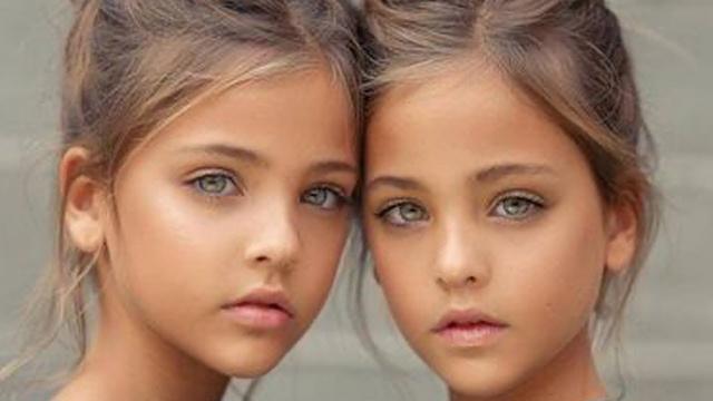 This Couple Gave Birth To The Most Beautiful Pair Of Twins, Look Where They Are Now