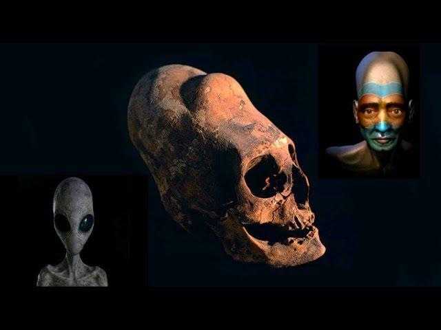 Shock verdict after DNA tests reveal where 'elongated heads came from'