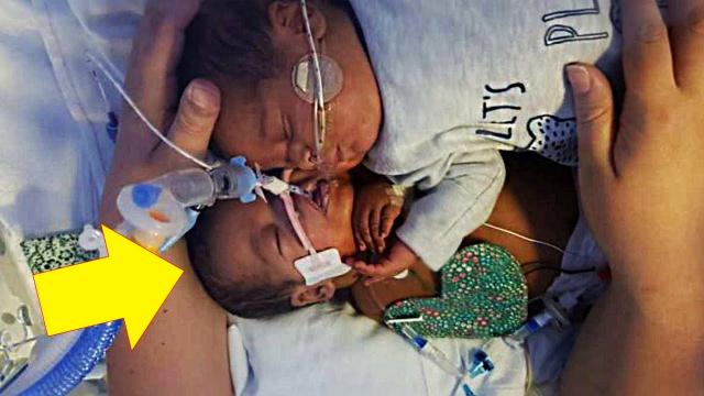 A Nurse places a healthy baby next to a dying twin and what happened left everyone speechless