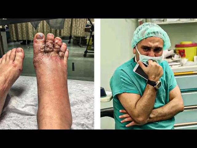 Couple Noticed Their Feet After Walk On Beach, Doctors Refused To Help