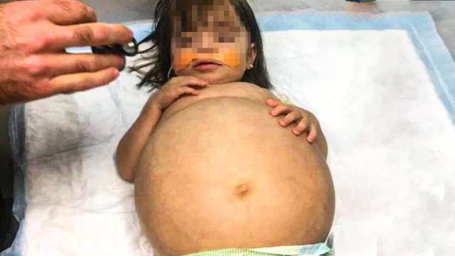 Baby Keeps Touching Belly – Doctor Is Surprised By The Reason