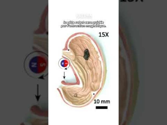 Un robot gluant et magnétique pour récupérer des objets dans le corps !