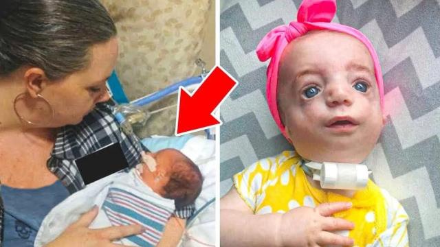 Baby with Down Syndrome Abandoned at Birth Becomes an Actress Years Later