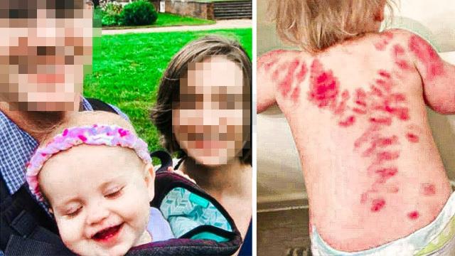Parents Discovered Strange Blood Marks on Their Son, They Called Cops Immediately  !