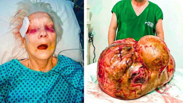 Elderly Woman Thinks She’s DYING, Then Doctor Reveals What They Found Inside ...