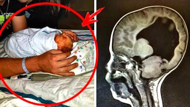 This Child Was Born Without a Brain But What Happened After 3 Years Was Shocking   !!