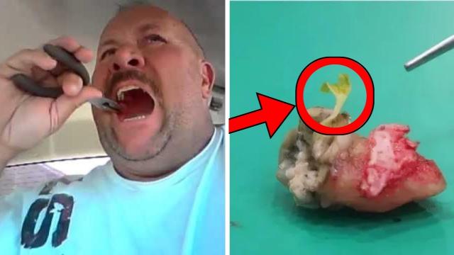 What Dentist Found Inside Man's Tooth Makes Him Call The News Immediately - No One Believed Him!