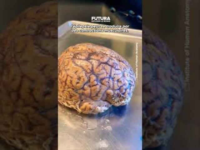 L’analyse et l’étude d’un vrai cerveau humain !