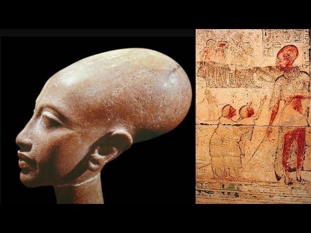 The Pyramids were built by a Race of Giants with Elongated Skulls