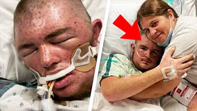 Man in agony after being stung by bees 20,000 times, swallowing 30