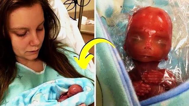 Baby Born at 18 Weeks When the Mother Put Him in Her Chest She Was Shocked
