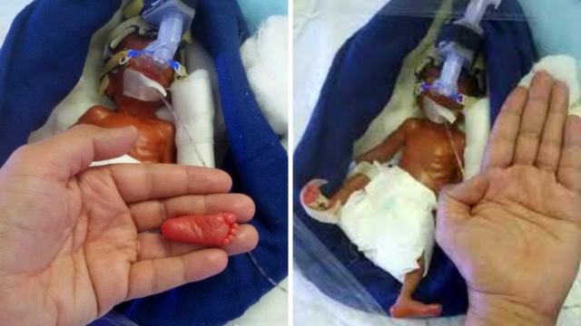 Widow Gives Birth To Miracle Baby 14 Months After Her Husband Passed away !