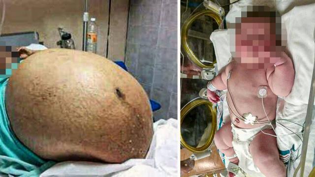 This Mom Gave Birth To A 13 Pound Boy Now The Photos Have Broken The Internet !