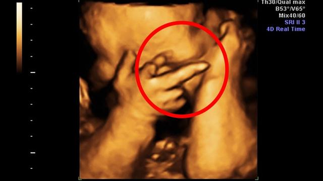 Mom Thinks She’s Pregnant With Twins, Doctor Freezes When He Sees Her Ultrasound