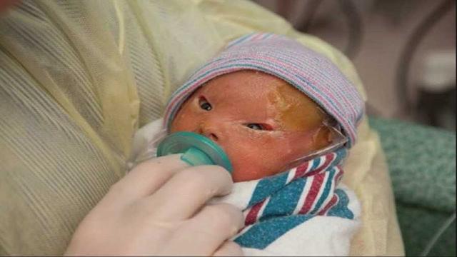Mom Is Shocked When She Sees Her Newborn In Delivery Room Now Her Words Are Spreading Like Wildfire
