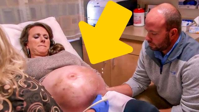 No One Believed What Doctors Found Inside This Women Belly Historical Precedent