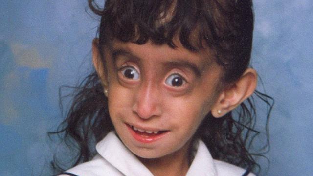 They called her ‘The world’s ugliest girl’, Here’s what happened to her now
