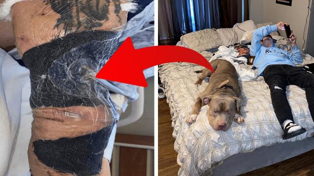 Pitbull slept in owner’s bed all the time until he tried to eat her alive in the most horrific way
