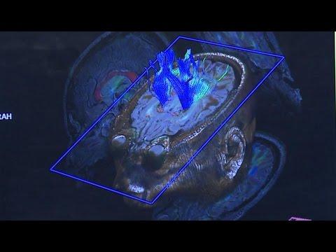 Space Station Live: MRI For Astronaut Vision Research