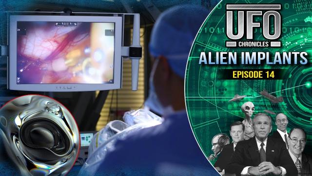E.T. Technology Under the Microscope &  Mysterious Alien Implants. Richard Dolan TV Series