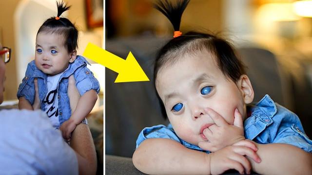 Nobody Wants The Blind Girl With Silver Eyes. Then Mom Sees A Detail In Photo And Realizes The Truth