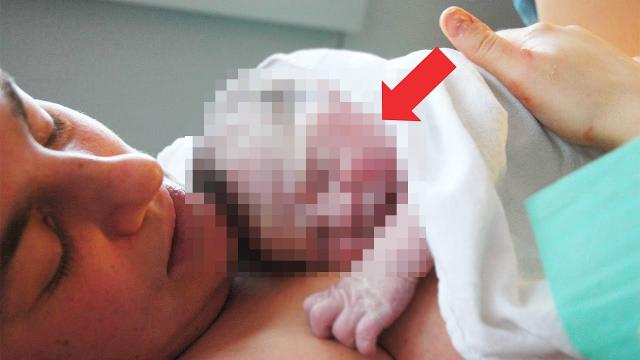 Nurse places a healthy baby on her dying mom, What happened left everyone dumbed down