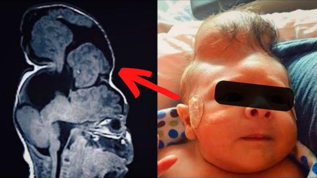 Doctors See Something Coming out of Baby’s Head, They Were Speechless When They Find Out What it Was