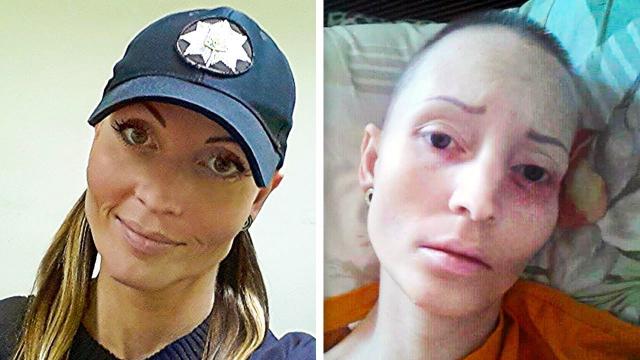 Cop Pass Away After Suspect Spat In Her Face. Then Police Reveal The Startling Cause