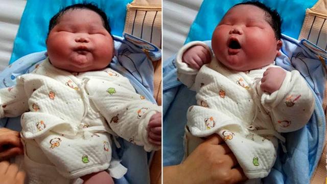 16 Pound Giant Baby Made Headlines in 1983 – Now He’s All Grown Up And Still Famous For His Size