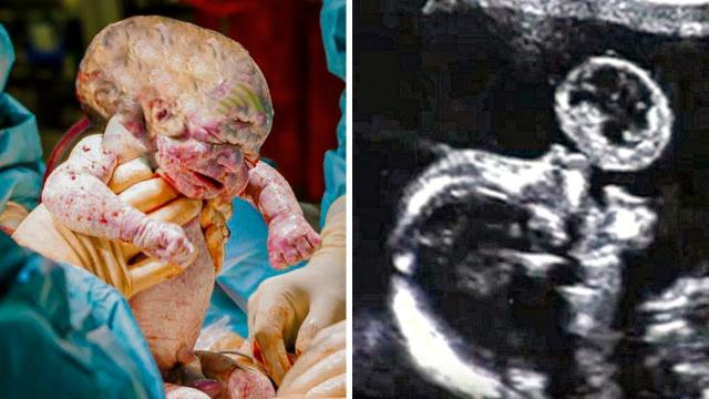A woman spent thousands of dollars to get pregnant When doctor saw the ultrasound, he was shocked