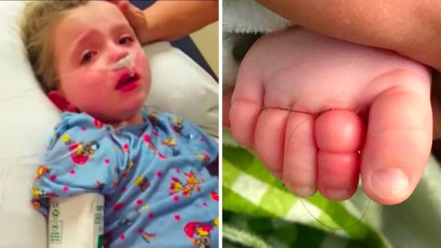 Mother Noticed a Strange Line On Her Baby’s Toe Immediately Called 911
