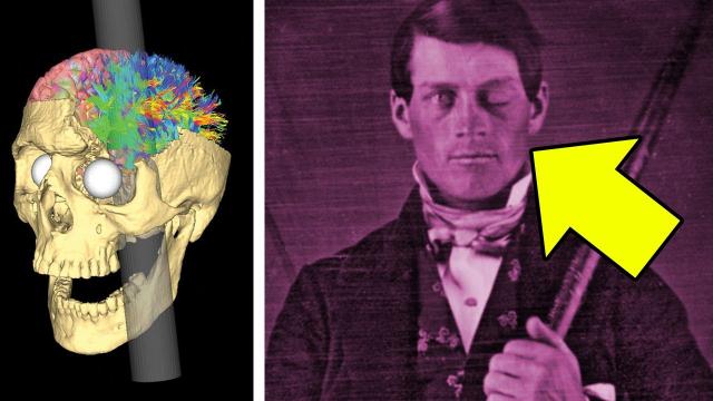 He Survived an Iron Rod Through His Brain — The Weird Story of Phineas Gage