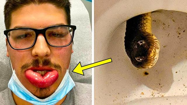 Man Finds "Snake" In His Toilet - When Expert Sees It, He Says: "It's Not A Snake..."