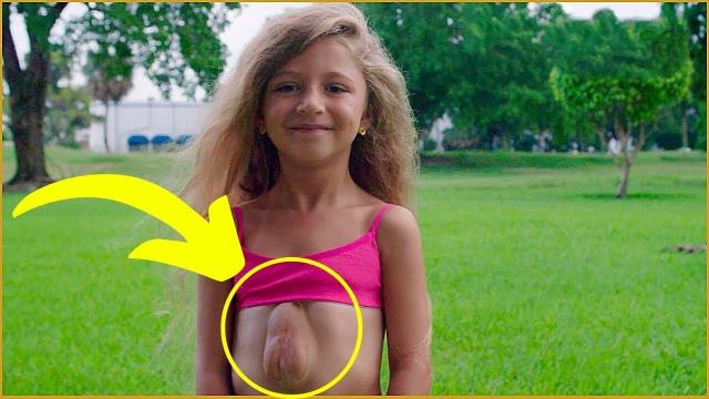 An 8 year old girl with a rare congenital condition that caused her heart to be outside her chest