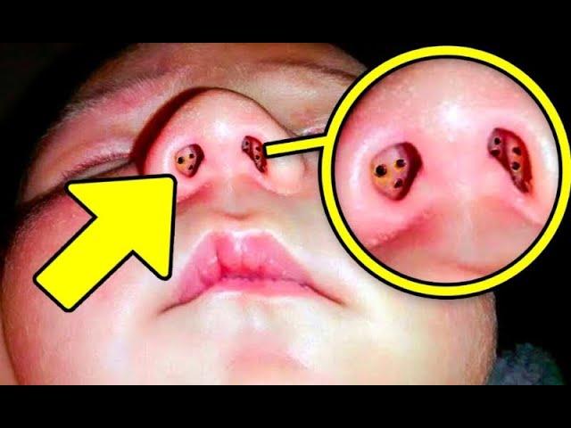 Baby Has Weird Holes Inside Nose - When The Doctors See It They Call The Police